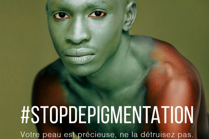 La dépigmentation chez les hommes en vogue