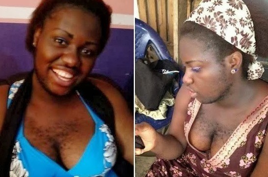 Voici la femme la plus velue du Nigeria et qui fait tourner la tête des hommes et des femmes