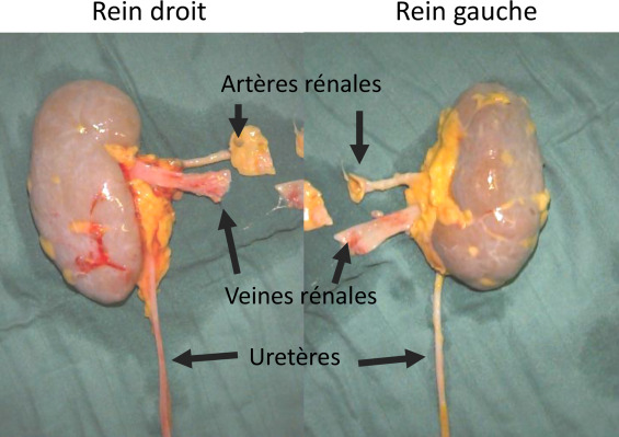 Santé : La transplantation rénale bientôt possible au Sénégal