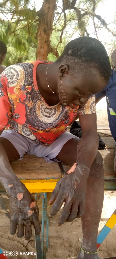 Photos-Video/ Affrontements entre pêcheurs de Cayar et Mboro: Plusieurs blessés enregistrés