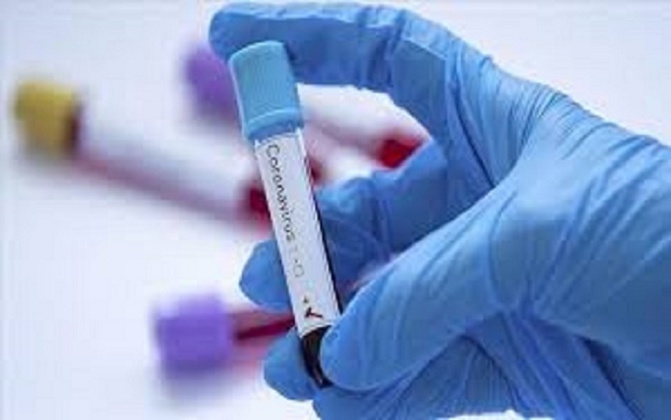 Alerte Santé - Hajj 2024 : Un taux de positivité au coronavirus de 20% à 60%, chez les pèlerins de retour d’Arabie Saoudite (Médecin)