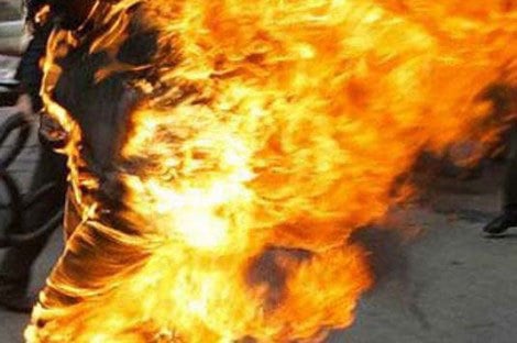 Yeumbeul Sud : Un homme meurt brûlé vif