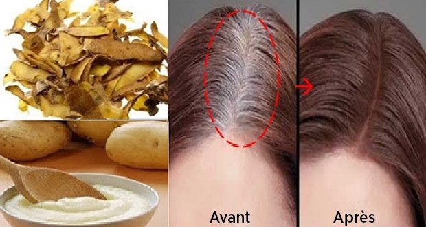 Astuce : Voici comment vous débarrasser des cheveux blancs naturellement