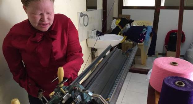 Cette femme albinos sans bras, possède une usine de tissage. Découvrez sa terrible mésaventure !