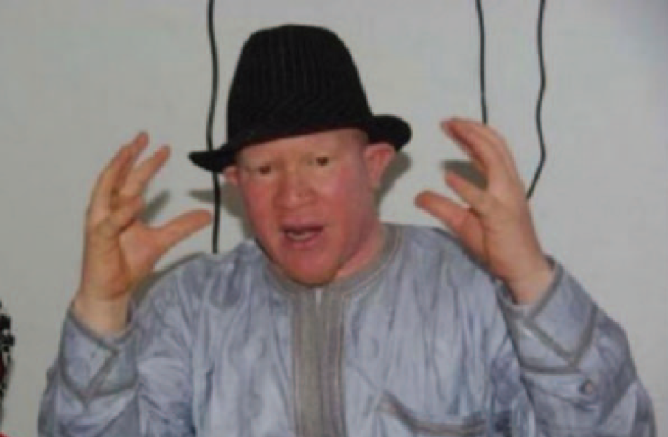 Guéguerre au sein de l’Association nationale des albinos du Sénégal : Les choses se corsent pour Ahmadou Bamba Diop