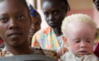 Afrique: «Les albinos sont considérés comme des êtres dotés de pouvoirs»