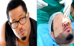 L’acteur nigérian Mike Ezuruonye a subi une chirurgie des yeux (photo)