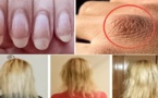 Si vous avez la peau sèche, les ongles cassants ou une chute de cheveux, vous devez d’urgence acheter ces ingrédients !