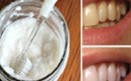 Comment blanchir les dents en 2 minutes