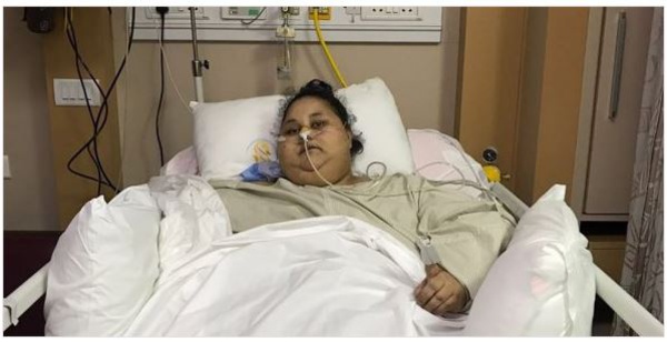 Égypte : la femme la plus grosse du monde perd 100 kilos en un mois grâce à son hospitalisation en Inde