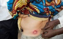 SÉVÈRE REPRESSION POLICIÈRE CONTRE LES JEUNES DE REBEUSS ET MÉDINA : 7 personnes arrêtées, Khalifa Sall malmené, Aly Aïdar reçoit une balle en caoutchouc