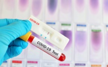 Covid-19: 82 nouvelles contaminations, 21 cas graves, 4 cas importés, 13 cas communautaires...