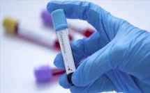 Covid-19: 11 749 Sénégalais déjà vaccinés, 76 365 personnes inscrites sur la plateforme