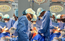 Santé- Nouvelle Prouesse  : Le Sénégal acte sa quatrième transplantation rénale