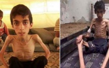 L'horreur à Madaya: "Les enfants mangent des feuilles et des chats pour survivre"